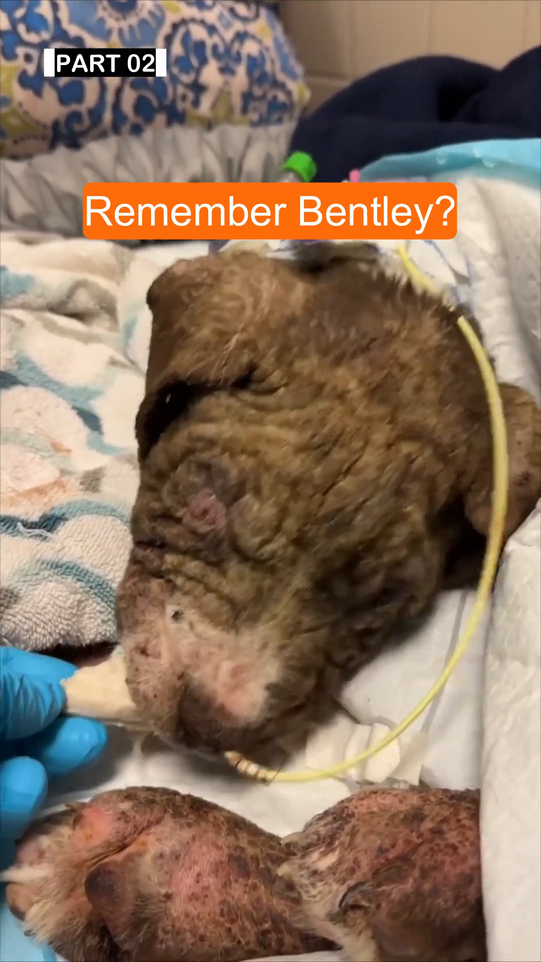 A close-up of Bentley's face, showing his severely affected skin and a medical tube.